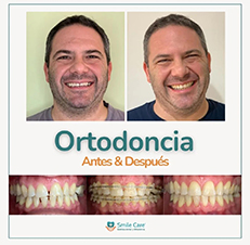 ortodonciaz4.jpg